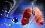 تزریق موفقیت آمیز سلول های دستکاری شده برای مقابله با سرطان ریه